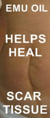 Ormus Minerals - Pure Emu Oil helps heal scar tissue